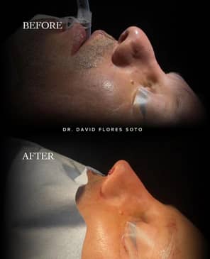 Slider image (9) Dr. David Flores Soto - DFS Plastic Surgery